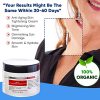 Moisturizer for Turkey Neck, Improves Lifting