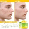 Revitalize Your Glow: O Naturals Exfoliating Lemon Oil Dead Sea Salt Scrub