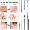 Blackhead Remover Face Mask Acne & Blackhead Extractor Kit