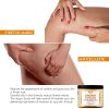 Dark Spot Age Spot Acne Stretch Mark Moisturizing Hydrating