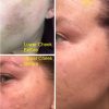 Ultra-Potent Brightening Serum Dark Spot Corrector Remover