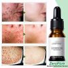 Anti-Aging Poreless Skin Tightening Serum