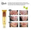 Revitalize Skin with Scar Removal Cream - Stretch Mark Aid and Burns Restore Gel for a Radiant Complexion