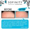 Retinol Cream for Face with Hyaluronic Acid
