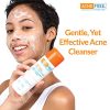 Oil-Free Acne Cleanse Benzoyl Peroxide