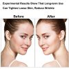 Facial Massager Anti Wrinkles Neck Massager