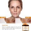 Dark Spot Age Spot Acne Stretch Mark Moisturizing Hydrating