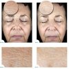 Glow Revival: Aquareveal Satin Bright Soft Water Peel for Radiant Skin