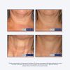 NeoStrata Skin Active Triple Firming Neck Cream