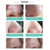 Peel off Blackhead Removal Mask Deep Cleaning