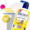 Salicylic Acid for Acne Prone Skin