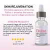 Acne Scarring, Wrinkles Acid Skin Peel