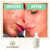 Face Cleanser Facial Wash to Moisturize
