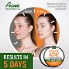 Cystic Acne Treatment and Acne Scar Remover