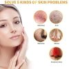 24K Gold Extract Anti-Aging, Deep Cleansing Blackhead ＆ Acne Scars