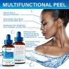 Acne Scars Glycolic Acid Peel 70% - Made in US