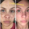 Ultra-Potent Brightening Serum Dark Spot Corrector Remover