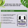 Moisturizer Cream for Face Facial Cream with Hyaluronic Acid