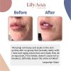 LilyAna Naturals Retinol Face Cream – Anti-Aging & Moisturizing Formula