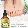 100% Pure Australian Tea Tree Essential Oil with high of Terpinen