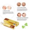 Revitalize Skin with Scar Removal Cream - Stretch Mark Aid and Burns Restore Gel for a Radiant Complexion
