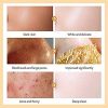 Blackhead Peel off 24K Gold Mask