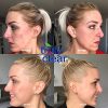 Blemish Face Wash Acne Treatment