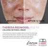 Retinol Cream (30 mL) Anti-Aging Day and Night Facial