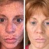 Ultra-Potent Brightening Serum Dark Spot Corrector Remover