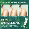 Korean Skin Care Skin Tag Remover