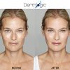 Anti Aging Resurfacing Exfoliate Peel Pads