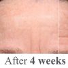 Anti Aging Retinol Moisturizer Cream: for Face