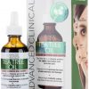 Redness and Bumps Treatment and Prevention