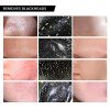 Peel Off Blackhead Face Mask