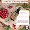 Face PURA D'OR Organic Rosehip Seed OilRosehip Seed Oil (4oz / 118mL) 100% Pure Cold Pressed USDA Certified Organic, All Natural Anti-Aging Moisturizer Treatment for Face, Hair, Skin, Nails, Men-Women (Packaging may vary)