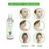 Aloe Vera Gel Face Moisturizer Anti Wrinkle
