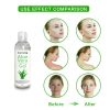 Aloe Vera Gel Face Moisturizer Anti Wrinkle Whitening Face Cream