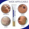 Anti Acne Cream Oil Control Shrink Pores Moisturizer Face Care
