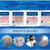 Anti-Aging Whitening Wrinkle Removal Face Cream