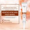Anti-acne Cream Acne Blackhead Face Cream Treatment