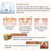 Anti-acne Cream Acne Blackhead Face Cream Treatment