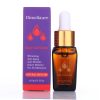 Arbutin 5% Whitening Freckle Cream + Kojic Acid Serum for Dark Spots, Melasma & Acne – Effective Skin Brightening Moisturizer