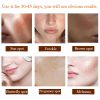 Arbutin 5% Whitening Freckle Cream + Kojic Acid Serum for Dark Spots, Melasma & Acne – Effective Skin Brightening Moisturizer