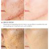 Scar Repair Toner – Brightens, Shrinks Pores & Revitalizes Skin