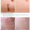 Scar Repair Toner – Brightens, Shrinks Pores & Revitalizes Skin
