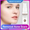 A hydrating face toner for acne scars, pore reduction, and brighter skin with natural extracts and anti-aging benefits. 
