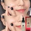 Dark Spot Removal Face Wart Tag Freckle Removal