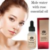 Dark Spot Removal Face Wart Tag Freckle Removal