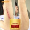 Face Cream Scar Removal Acne Treatment Repairing