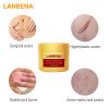 Face Cream Scar Removal Acne Treatment Repairing